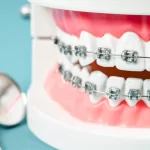 List of top rated best Orthodontist in Maine