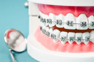 List of top rated best Orthodontist in Maine
