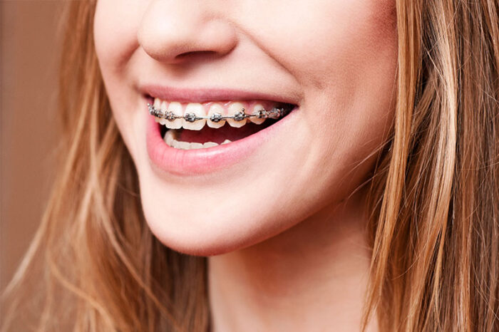 List Of Top Rated Best Orthodontist In kansas, Hanover