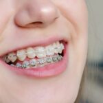 Top Orthodontists in Florida's Panhandle