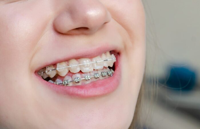 Top Orthodontists in Florida's Panhandle