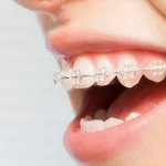 Top Orthodontists in Southern Nevada