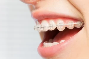 Top Orthodontists in Southern Nevada